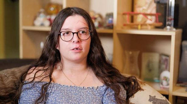  Caitlin is now recovering at home