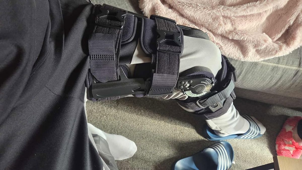 Alex's leg brace; he said he still has serious issues with mobility