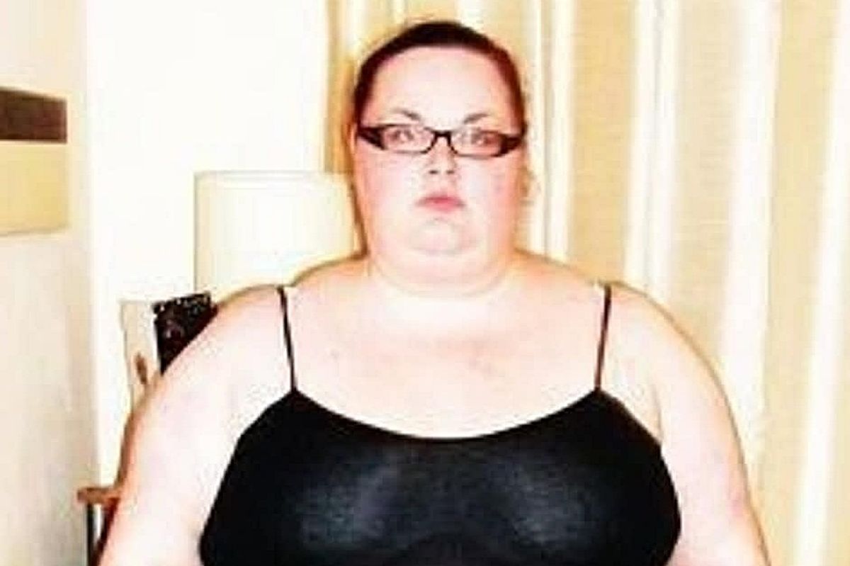 Lea Nicholson before gastric sleeve surgery