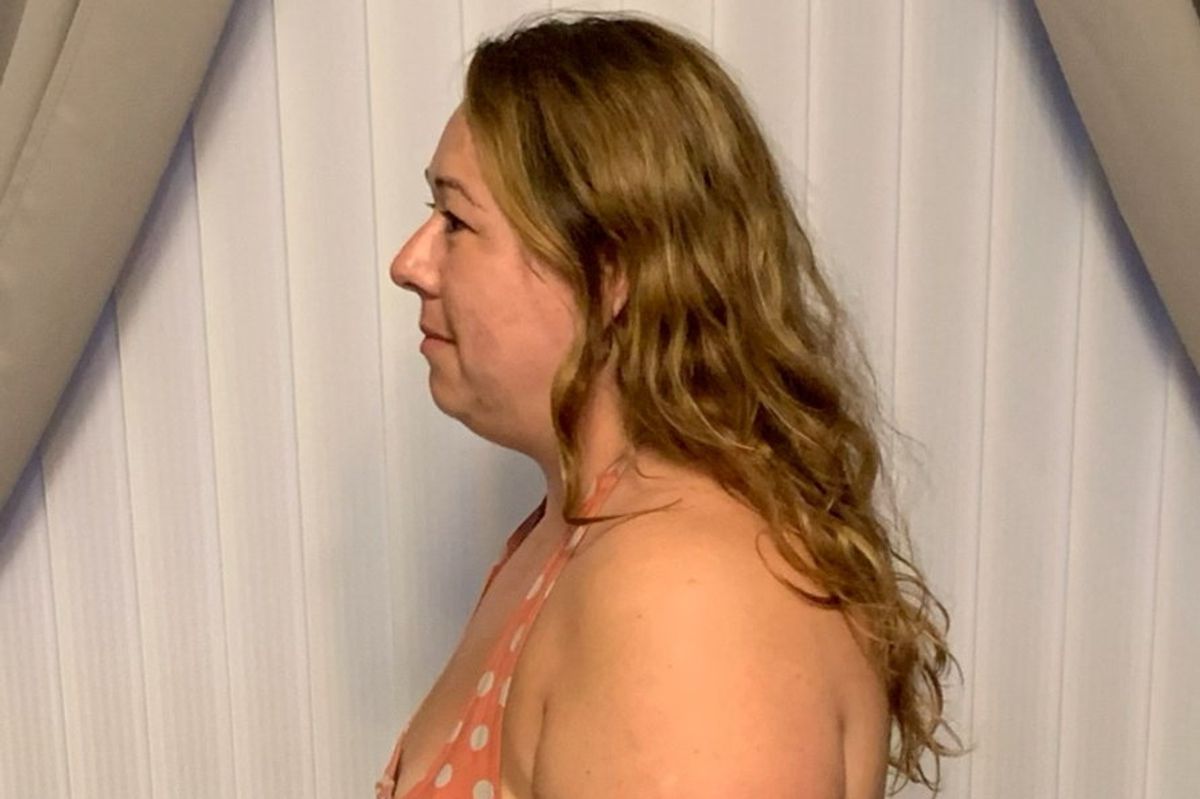  Bethany Wragg before her weight loss