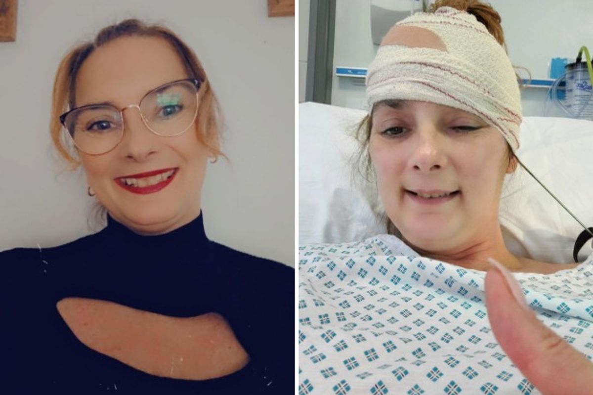 Stacey Duffy, 48, of Goole who is living with a brain tumour