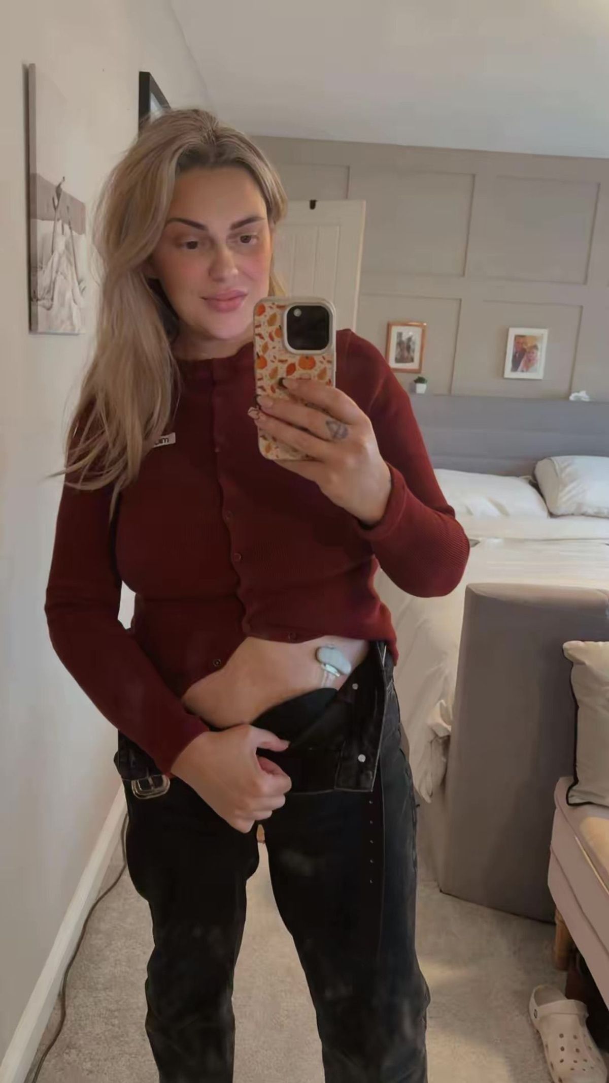 Beverley mum-of-three Jenna Robinson, whose life has been changed by a stoma bag, wants to see more awareness and understanding for people with stomas