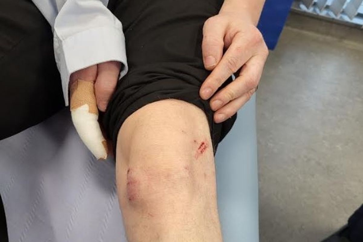 Humberside Police admitted liability following the dog attack.