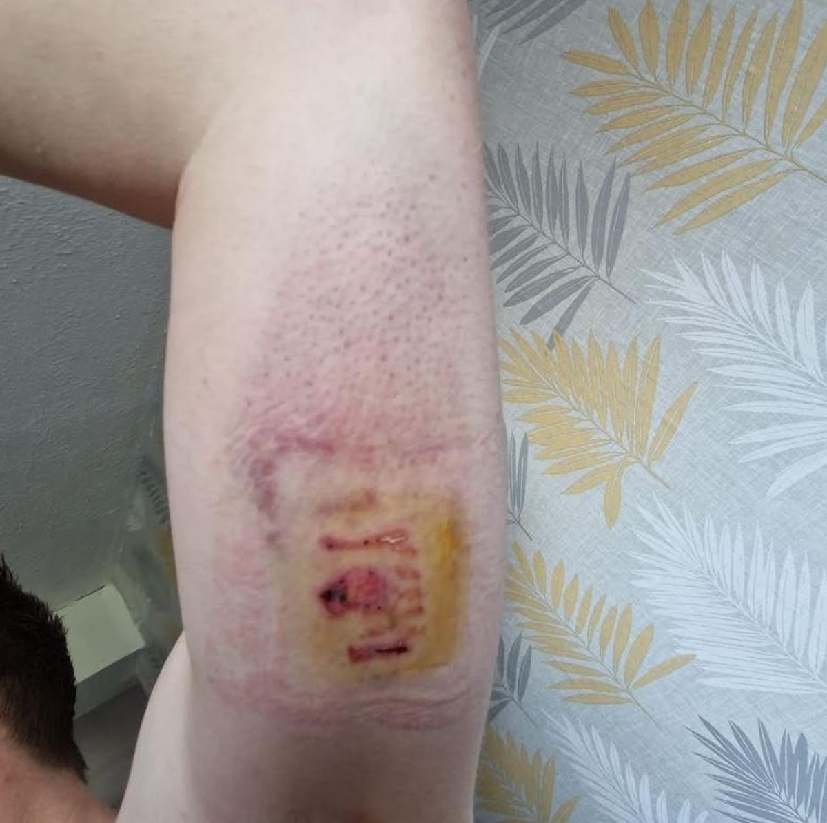 Patrick Bryant secured compensation following the attack.