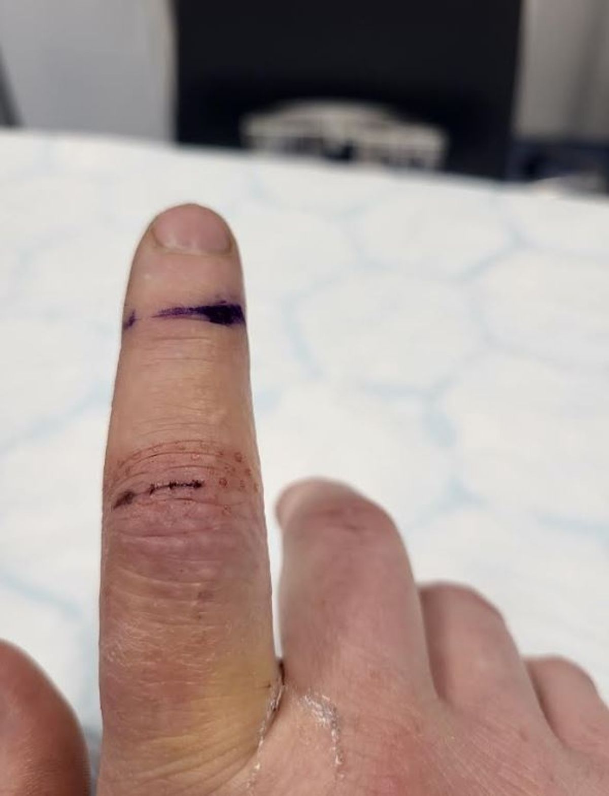 Hudgells Solicitors helped Patrick Bryant secure compensation.