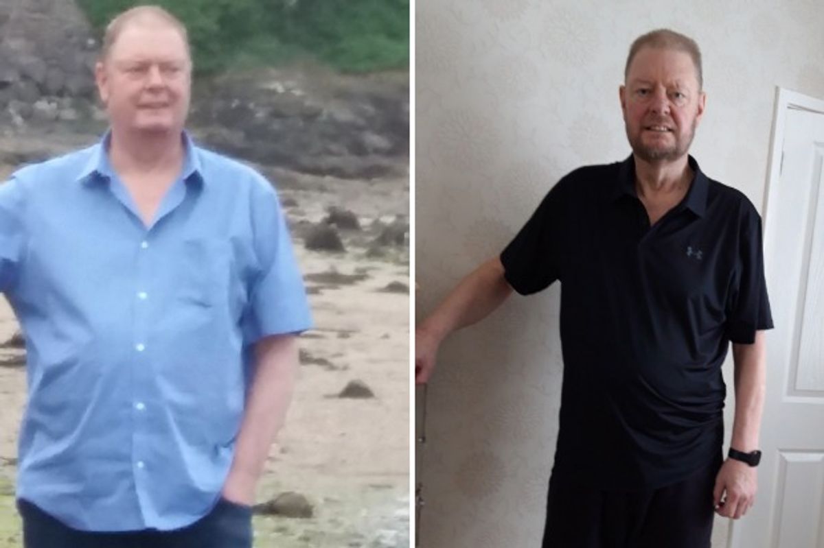 Left, Lionel Harrall before his abdominal aortic aneurysm surgery, and right, post-surgery - and 4 stones lighter