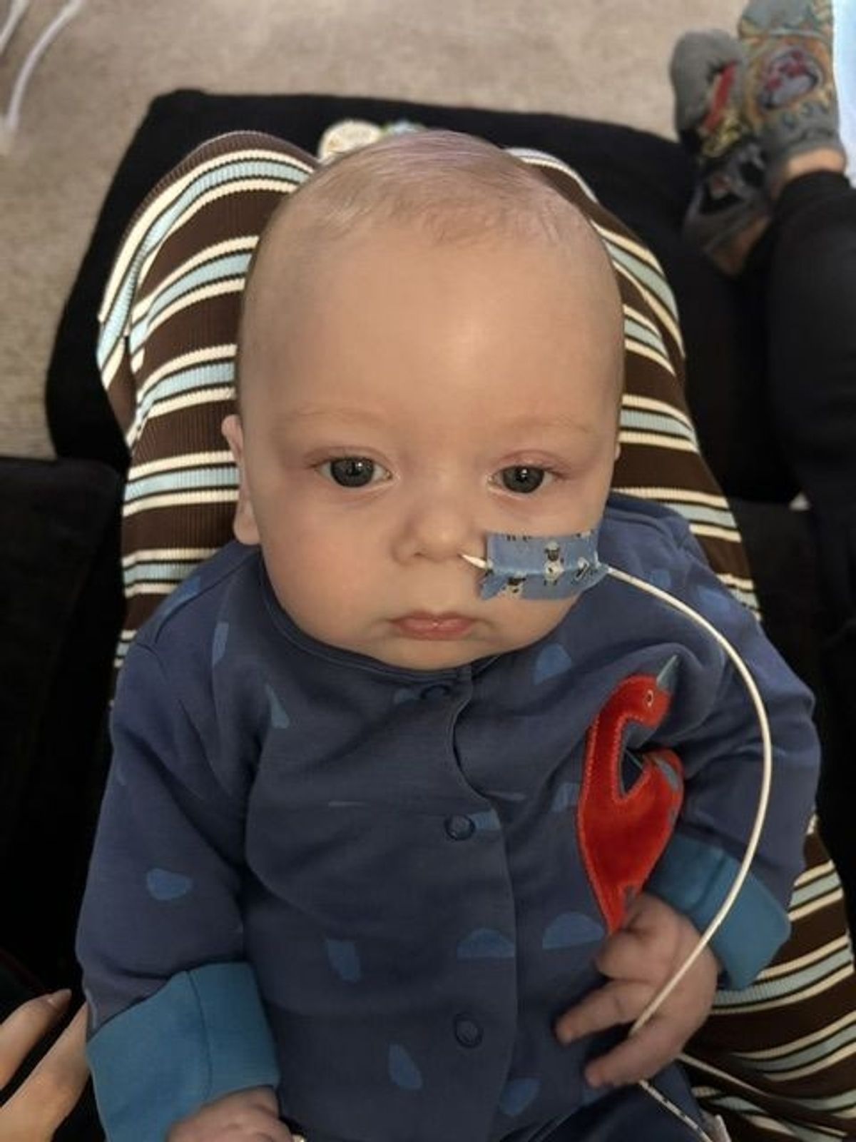 Hull baby Otto Sparkes has been diagnosed with the rare disease, Krabbe leukodystrophy