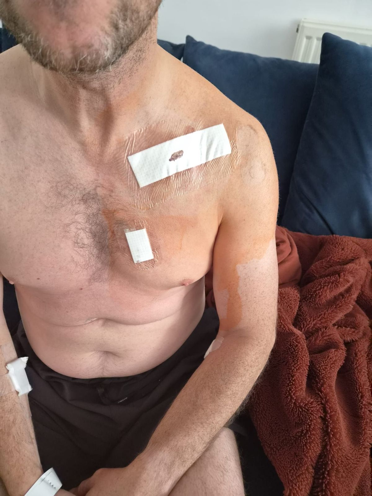 'What a difference a week makes' - Ant Lewis, recovering from his pacemaker operation