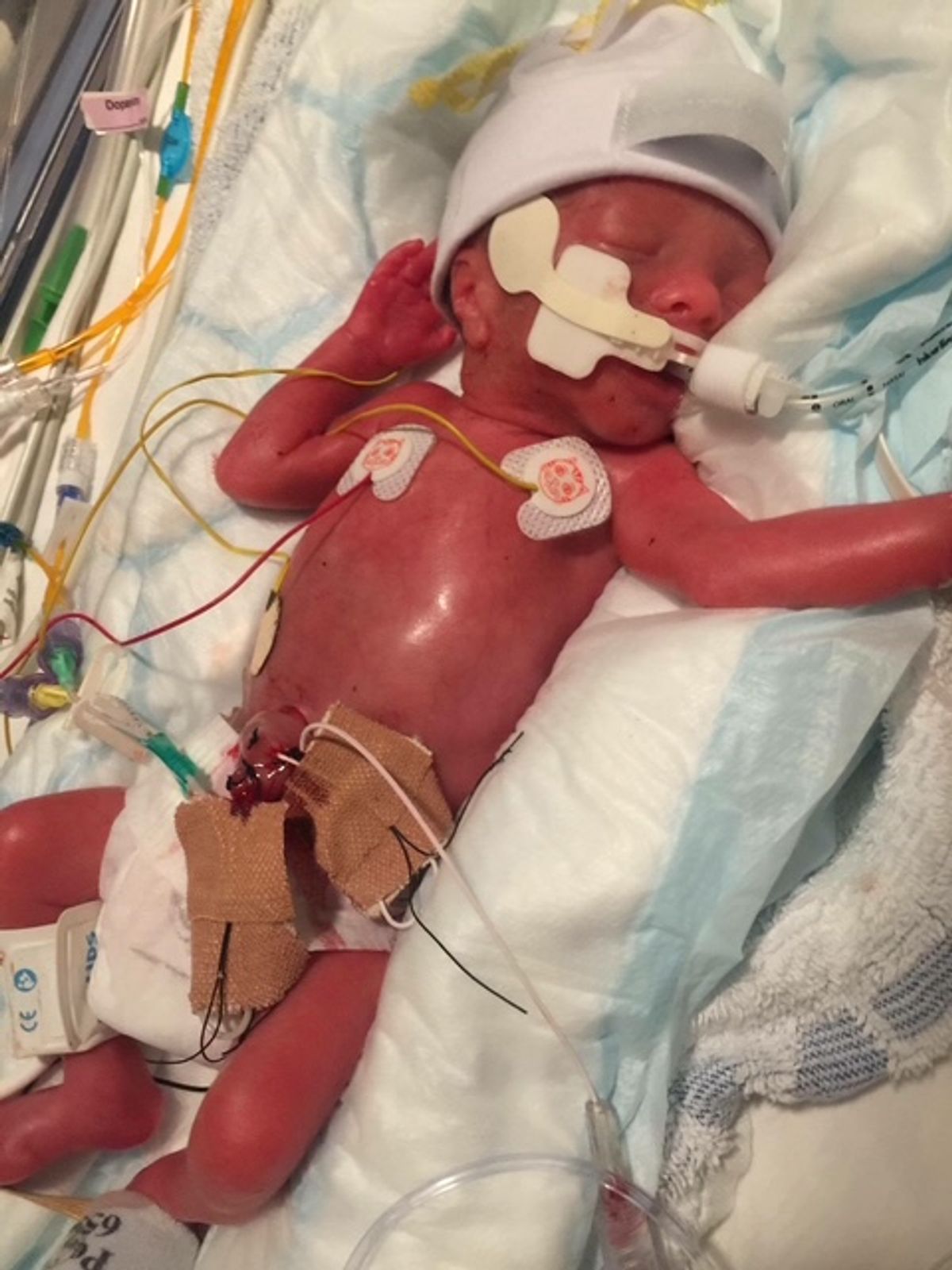 Jaxon Na'ama as a new baby lying in an incubator
