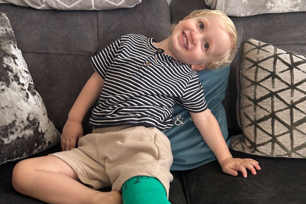 Carson Lees, 2, at home with a cast on his leg
