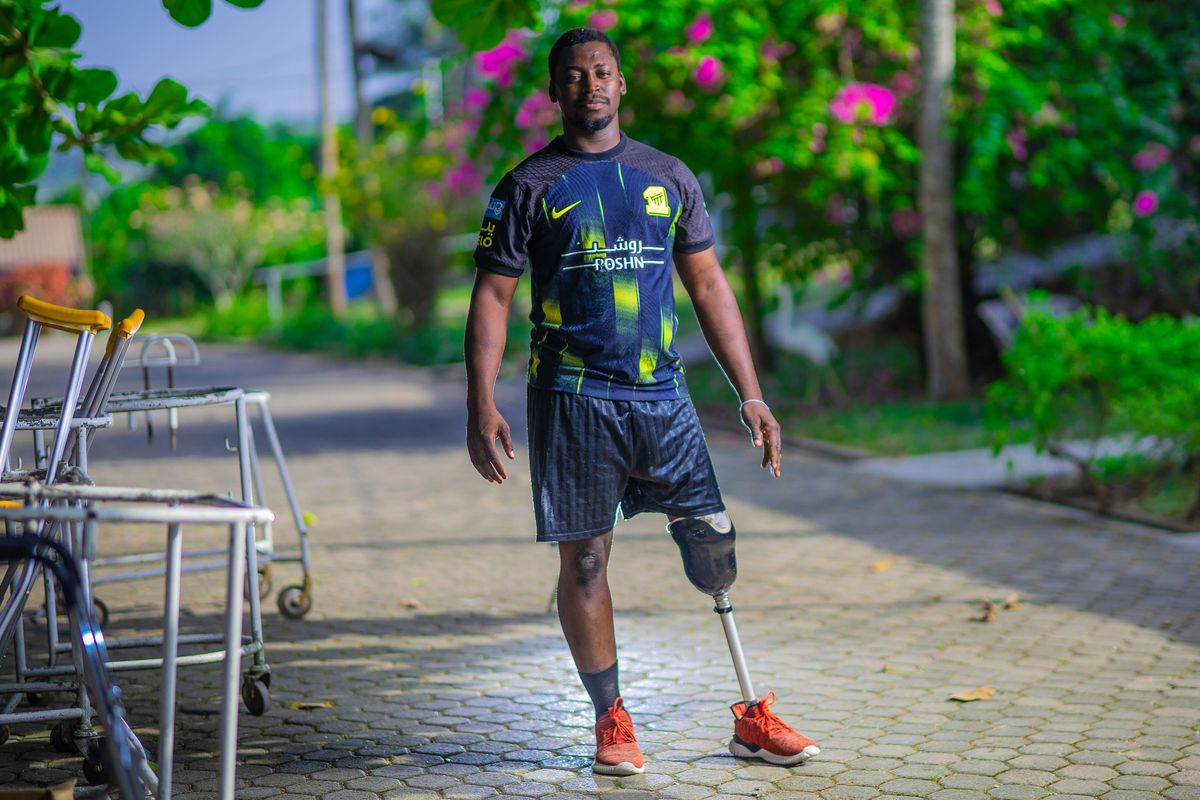 Isaac from Ghana, with a donated leg from STAND