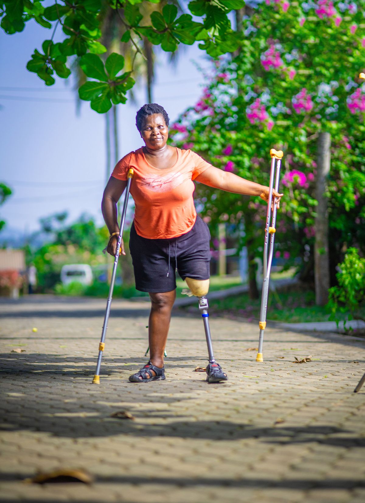 Catherine from Ghana lost her leg in a road traffic accident, and now has been fitted with a leg from STAND